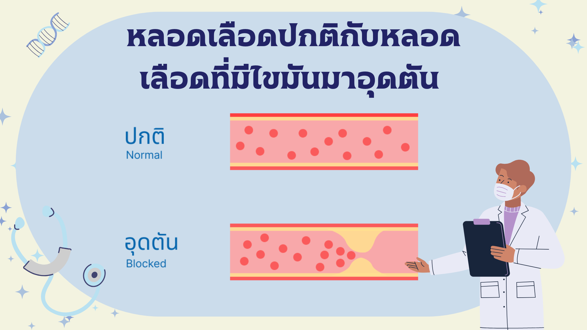 หลอดเลือดปกติกับหลอดเลือดที่มีไขมันมาอุดตัน